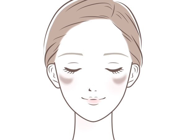 肝斑