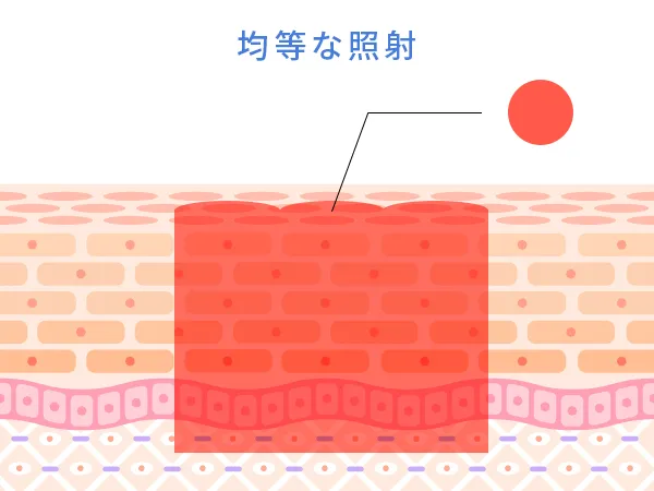 均等な照射