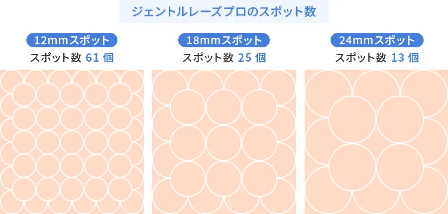 ジェントルマックスプロのスポット数