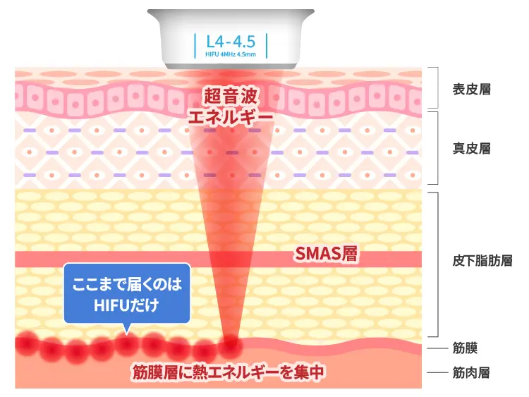 ハイフとは