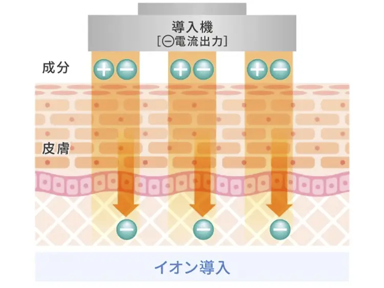 イオン導入の仕組み