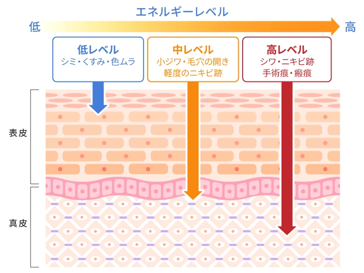 エネルギーと深度の関係