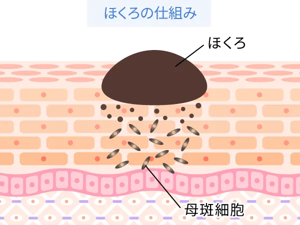 母斑細胞が集まる様子