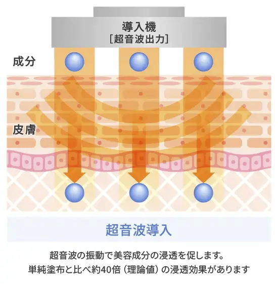 超音波導入