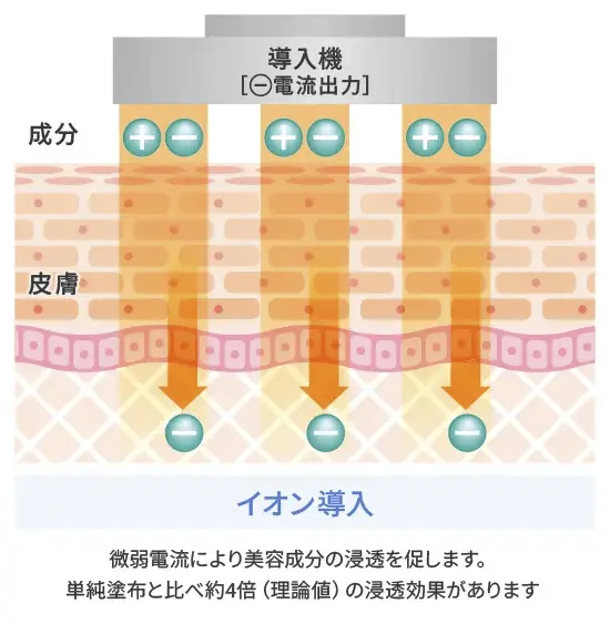 イオン導入