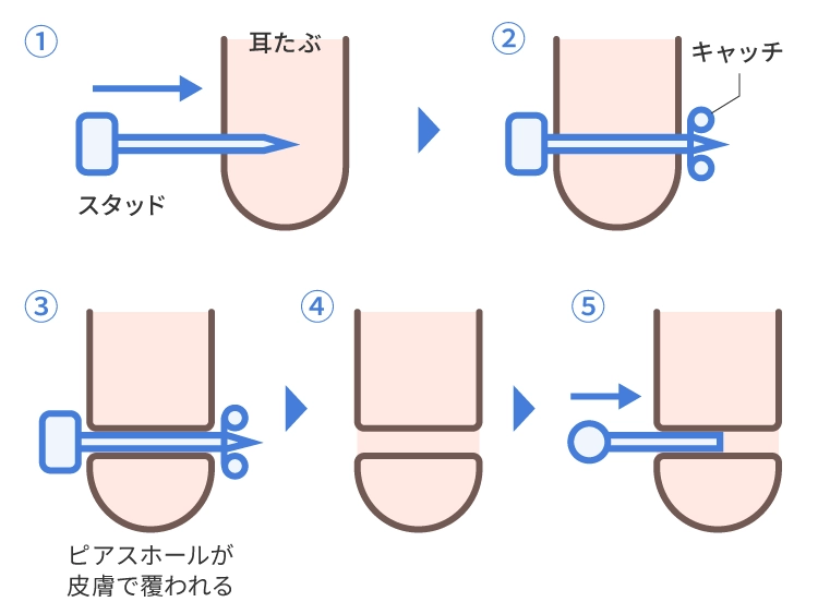 ピアスホールが完成するまでの経過