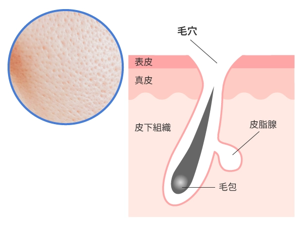 開き毛穴