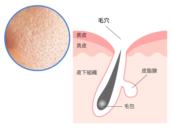 たるみ毛穴