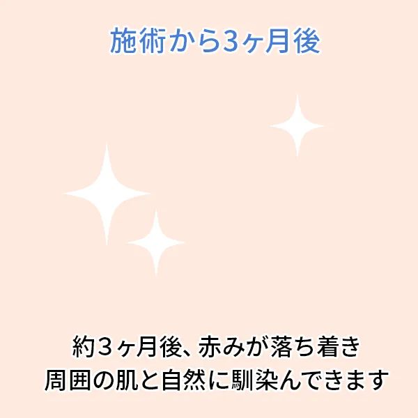 シミ取りレーザー後の経過：3ヶ月後