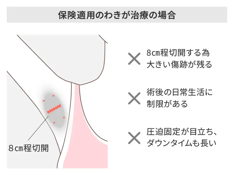 保険治療との違い