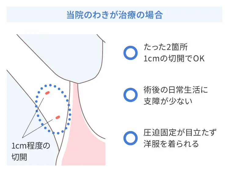 保険治療との違い